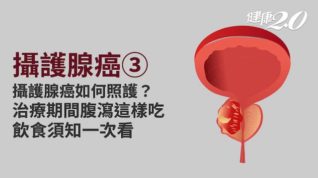 攝護腺癌／治療攝護腺癌容易腹瀉免驚！3種療法照護方式全掌握 荷爾蒙治療多補鈣