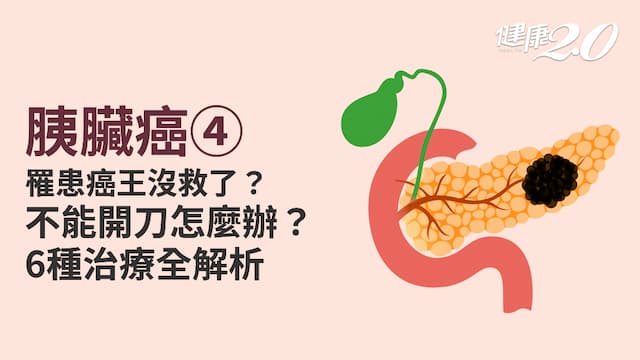 胰臟癌／罹患癌王沒救了嗎？6種檢查方法救一命！胰臟癌6治療方式別放棄