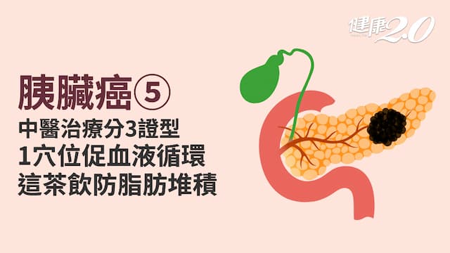 胰臟癌／中醫可以治療胰臟癌嗎？快按1穴位促進胰臟血液循環 1茶飲防脂肪堆積