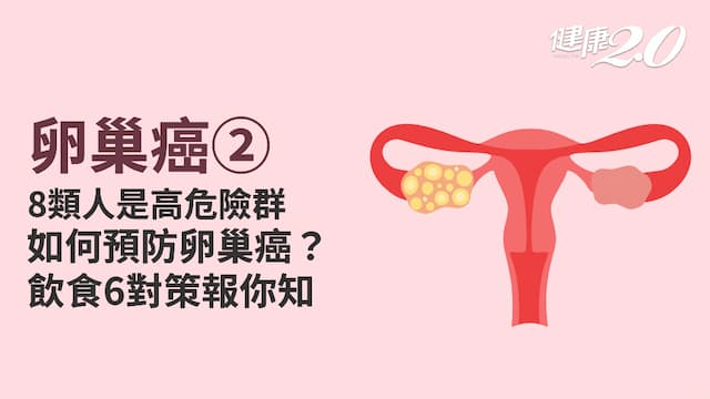 卵巢癌／5方法積極預防卵巢癌！高危險群必做2檢查 飲食掌握「4要2不」