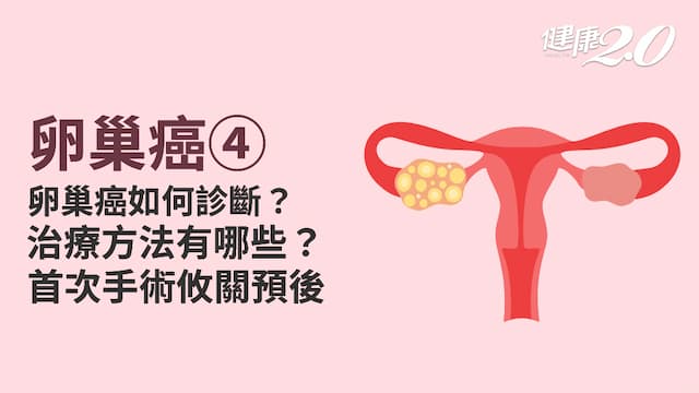 卵巢癌／初次手術成功減積 <span style="color:#1BA42B;">卵巢癌存活率</span>可多1倍！1情況可用荷爾蒙治療