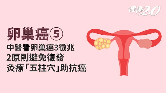 卵巢癌／中醫4招治療卵巢癌！3湯藥提升抗病力 中西合併成抗癌趨勢 