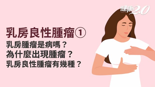 乳房良性腫瘤／乳房摸到硬塊是乳癌？4種乳房良性腫瘤報你知