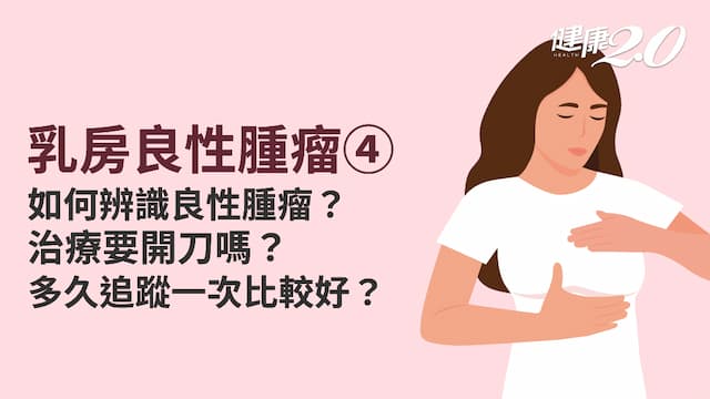 乳房良性腫瘤／乳房良性腫瘤要開刀嗎？這1種腫瘤可能撐到皮膚表面、易癌化 3種情況需密集追蹤