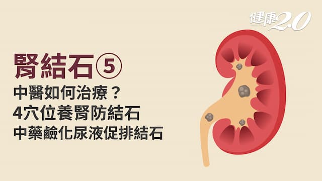 腎結石／中醫治療腎結石分4體質！喝這杯「排石方」很有效 4穴位養腎防結石