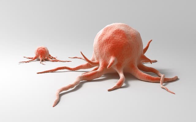 瘜肉變大腸癌 71萬年輕人有風險