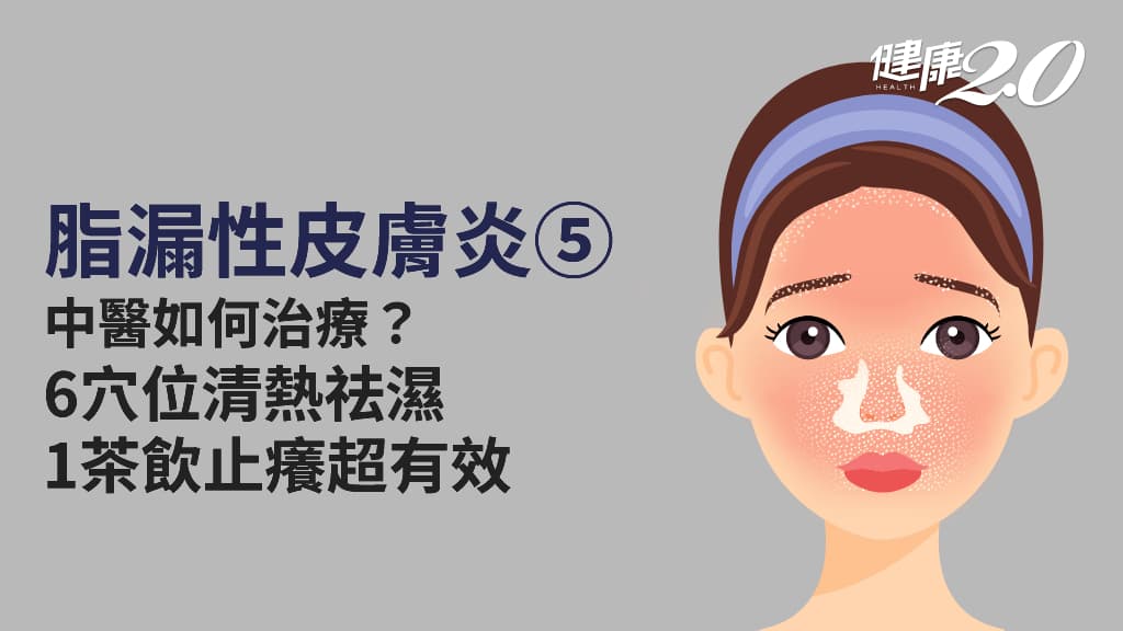 醫學百科主圖_脂漏性皮膚炎5