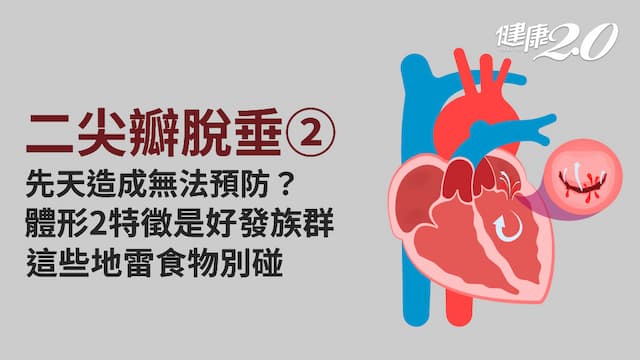 二尖瓣脫垂／「模特兒病」易感焦慮 高瘦身材惹的禍！4生活對策避免發作