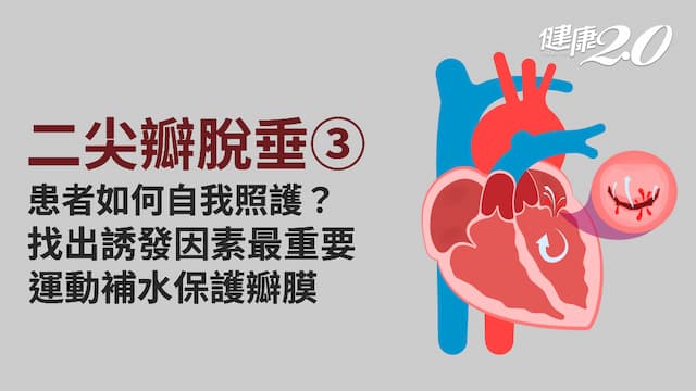 二尖瓣脫垂／心臟也要水噹噹！6招自我照護 吃錯食物恐發心悸