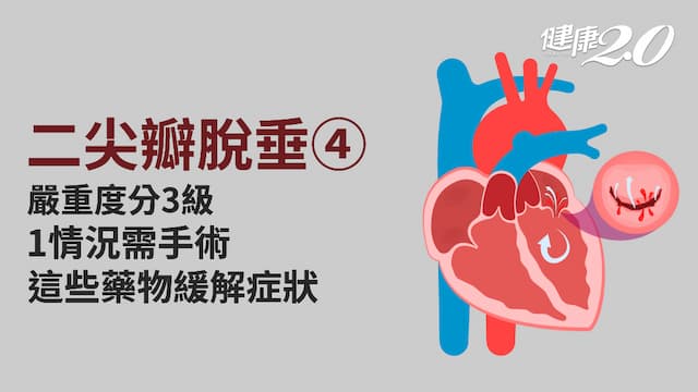 二尖瓣脫垂／診斷3利器揪出二尖瓣脫垂 藥物降血壓<span style="color:#1BA42B;">緩解焦慮</span> 手術修補瓣膜風險低