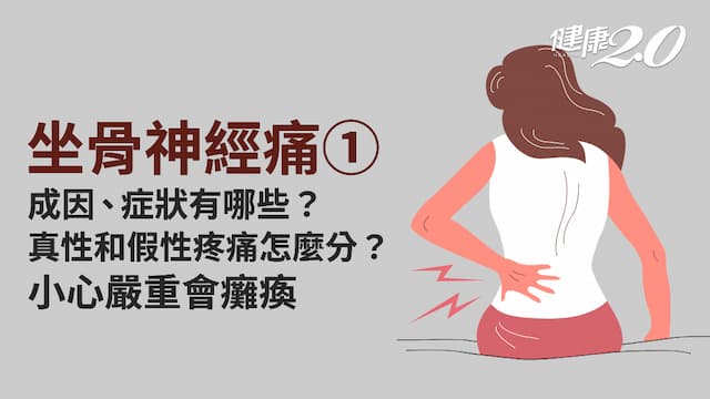 坐骨神經痛／臀腿痛到無力！哪些症狀是坐骨神經痛？嚴重恐失禁、癱瘓