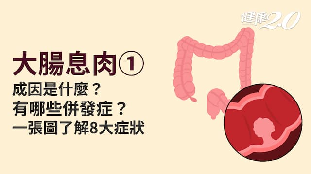 大腸息肉／為什麼會長大腸息肉？大腸息肉有哪些症狀？這類大腸息肉恐變大腸癌