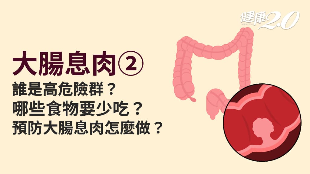 醫學百科主圖_大腸息肉2