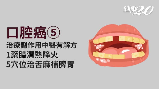口腔癌／中醫緩解口腔黏膜發炎 穴位治療舌肌麻痺 1藥膳清熱降火