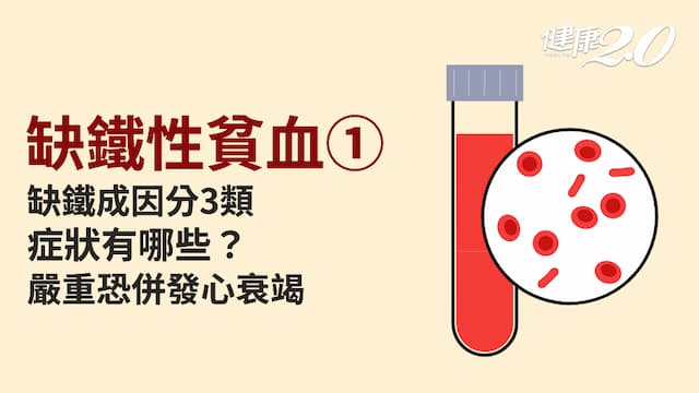 缺鐵性貧血／臉色蒼白、虛弱暈眩恐是缺鐵性貧血！小心指甲變形 嚴重還胃病、心衰竭