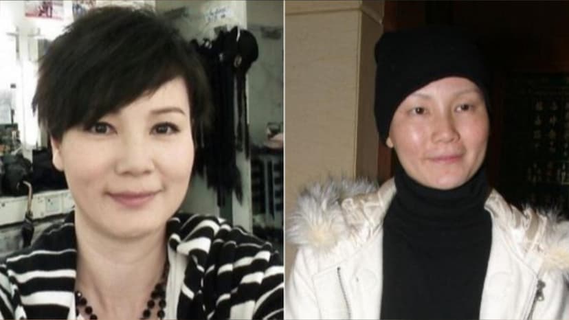 資深港星乳癌復發病逝！切乳抗癌18年、為何還會復發？醫曝關鍵1動作及早發現/cancer/339739