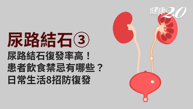 尿路結石／尿路結石5年復發率高達5成！患者日常要注意什麼？哪些食物不要吃？