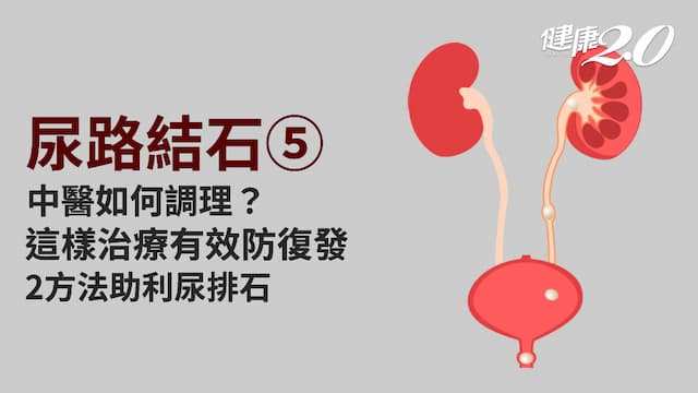 尿路結石／尿路結石中醫治療有效防復發！2方法防結石形成 2藥方助頑石排出