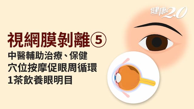 視網膜剝離／中醫補肝腎治眼病！穴位刺激減緩玻璃體老化 1茶飲幫眼睛紓壓