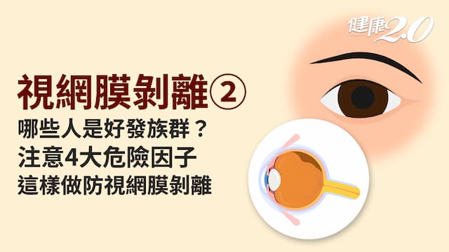 視網膜剝離／近視500度以上是高危險群！如何預防視網膜剝離？飛蚊症突然變多要警覺