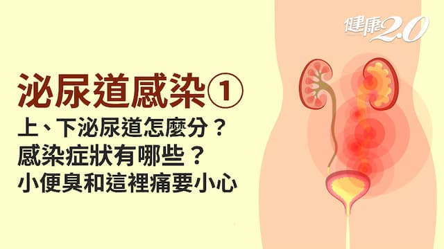 泌尿道感染／泌尿道警報：頻尿、血尿小心！腰痛合併寒顫、發燒 腎臟危險了