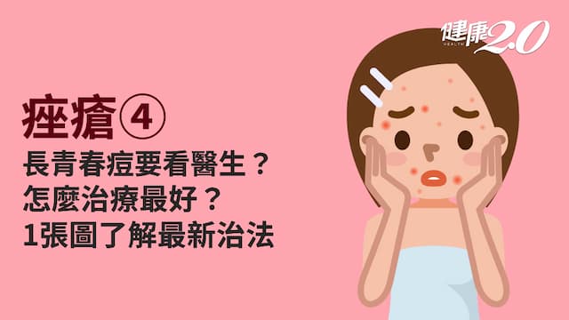 痤瘡／青春痘多久會好？治療青春痘方法有哪些？1動作千萬不能少