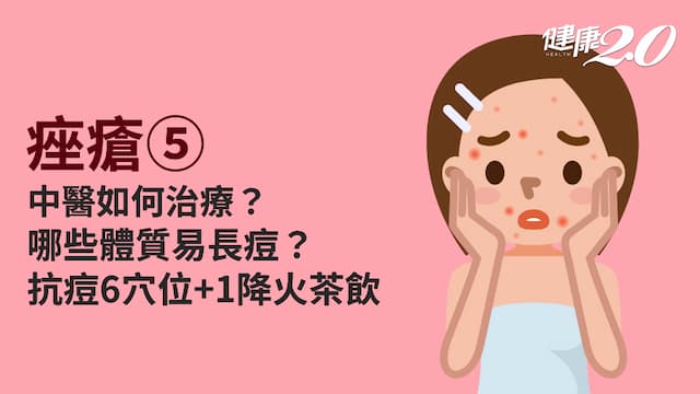 痤瘡／中醫可以治療青春痘？哪些穴位能抗痘？1茶飲降火去痘很有效