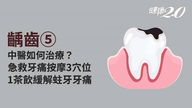 齲齒／中醫可以治療蛀牙？牙痛急救怎麼做？哪些穴位、茶飲可以緩解牙痛？