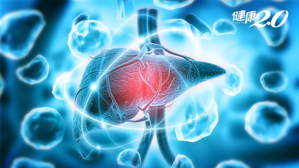 81晚期肝癌創新免疫合併療法納健保！患者存活期延長5.8個月 年省300萬元