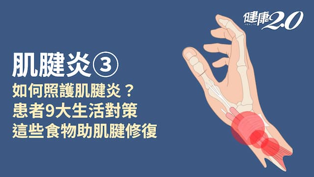 肌腱炎／如何舒緩肌腱炎？加速肌腱修復怎麼吃？患者生活對策一次看