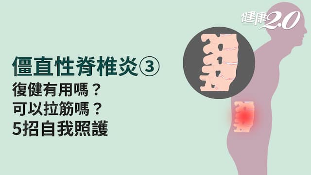 僵直性脊椎炎／寢具怎麼選？可以運動嗎？復健會好嗎？完全照護方法在這