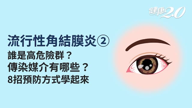 <span style="color:#1BA42B;">流行性角結膜炎</span>／誰容易得<span style="color:#1BA42B;">流行性角結膜炎</span>？如何預防<span style="color:#1BA42B;">流行性角結膜炎</span>？游泳點眼藥水能預防<span style="color:#1BA42B;">流行性角結膜炎</span>？