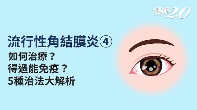 <span style="color:#1BA42B;">流行性角結膜炎</span>／不治療會好嗎？冷敷、點人工淚液有效嗎？如何治療<span style="color:#1BA42B;">流行性角結膜炎</span>好得快？