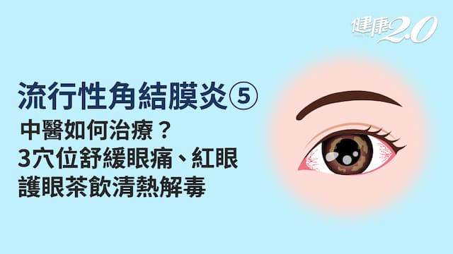 <span style="color:#1BA42B;">流行性角結膜炎</span>／中醫如何治療<span style="color:#1BA42B;">流行性角結膜炎</span>？哪些穴位可以舒緩眼痛、紅眼？護眼茶飲怎麼喝？
