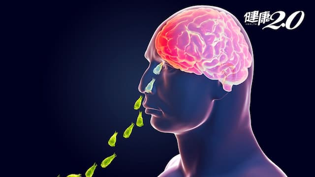 食腦蟲致死率99%！愛溫暖46℃快速生長 救命抗菌藥是孤兒藥 台大醫授2招預防