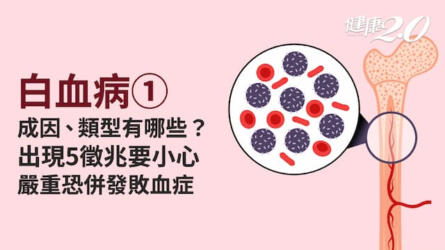 白血病／白血病=血癌？成因複雜 輻射汙染致病率高！4種類型、症狀看過來