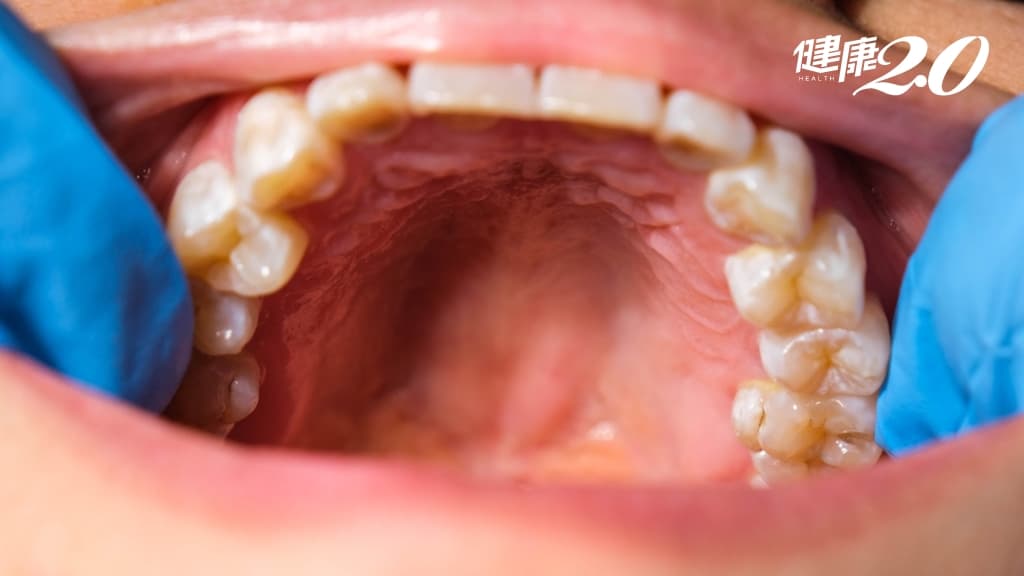 研究發現：人類「這部位」正在惡化！矯正這些生活習慣 避免自己變笨又變醜/life/343371