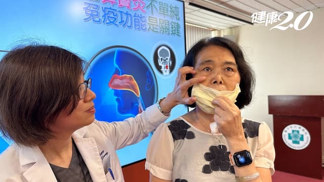 以為是單純鼻竇炎，結果竟是免疫疾病！她複視、眼腫脹、肺部腫塊 發現罕見血管炎