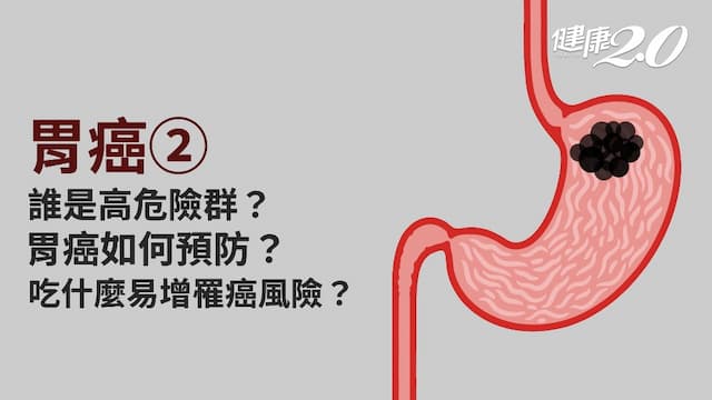 胃癌／愛吃重口味容易得胃癌？高危險群有哪些？多吃蔬果可以防胃癌？