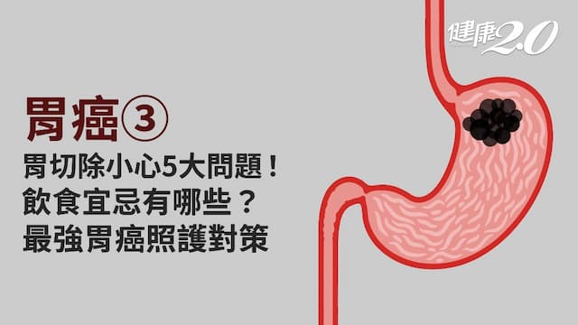 胃癌／胃癌切除要注意什麼問題？飲食原則有哪些？因應症狀的處置對策快收下