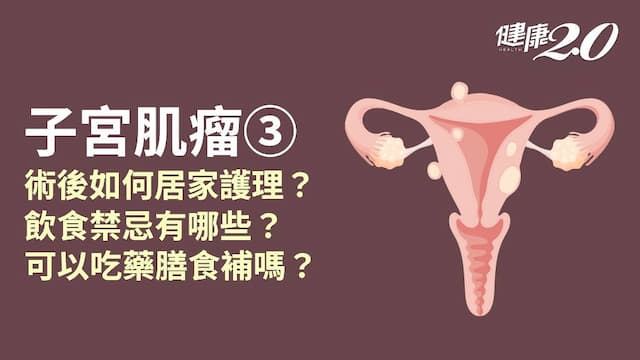子宮肌瘤／手術後還會有月經嗎？居家護理、復健看過來！哪些食物是地雷？