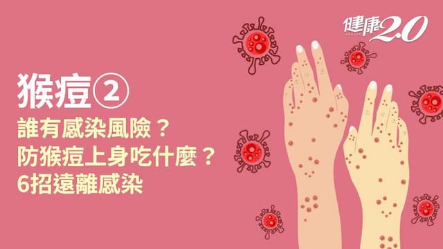 猴痘／誰是高風險族群？怎樣預防猴痘？3食物提升保護力