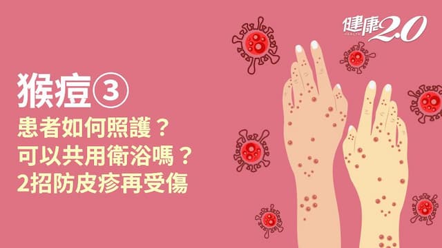 猴痘／罹患猴痘怎麼辦？如何防傳染？做好9件事才能快速痊癒