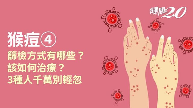 猴痘／得了猴痘會死嗎？治療方式有哪些？痊癒後還有傳染力嗎？