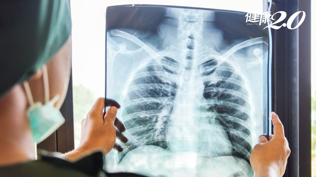 12歲童脖子腫1顆竟是肺癌轉移！爸媽疑2生活習慣惹禍，醫揭罹病真相/cancer/343247