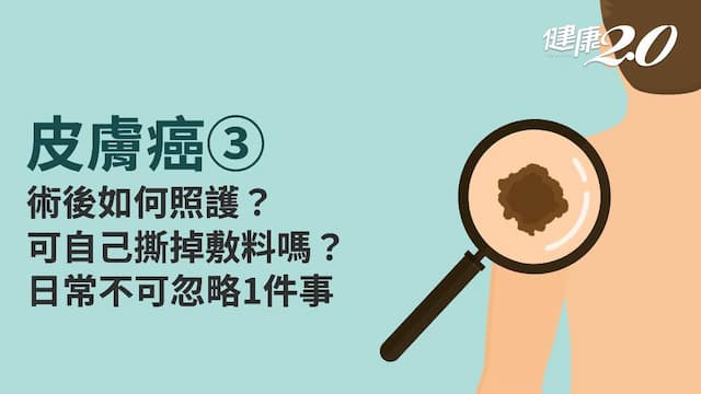 皮膚癌／皮膚癌如何照護？傷口會癢怎麼辦？預防復發防曬不可少
