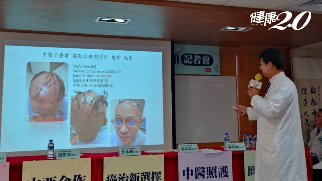 肺癌4期治好了、頭髮卻掉光 長庚中醫生髮奏奇效！新冠、疫苗、癌症掉髮都有效/tcm/343488