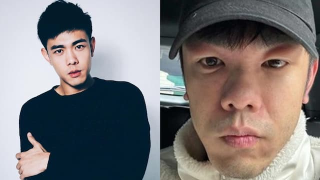 腫到變金魚眼！本土劇男星「蕁麻疹＋發高燒」臉腫一圈，醫曝4招舒緩紅腫癢