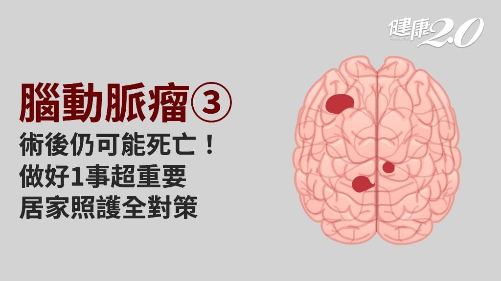 醫學百科主圖_腦動脈瘤3