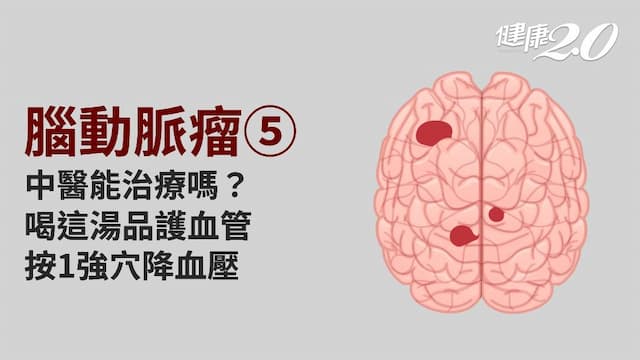腦動脈瘤／中醫如何治療腦動脈瘤？1穴位降壓保護血管 1食療改善預後預防復發